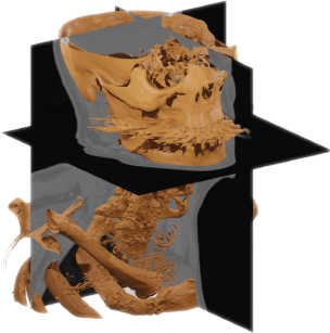 Threshold segmentation result