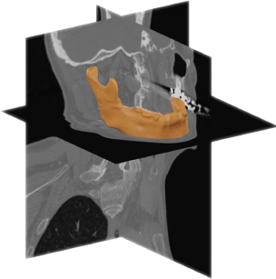 AI-generated anatomical model